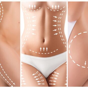 Combined procedures
